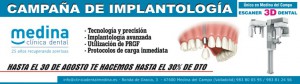 campaña implantes
