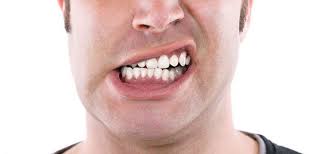 ¿Qué es la maloclusión dental?