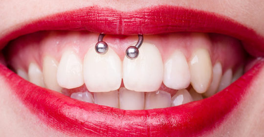 Los riesgos de los piercings orales para la salud dental pt2